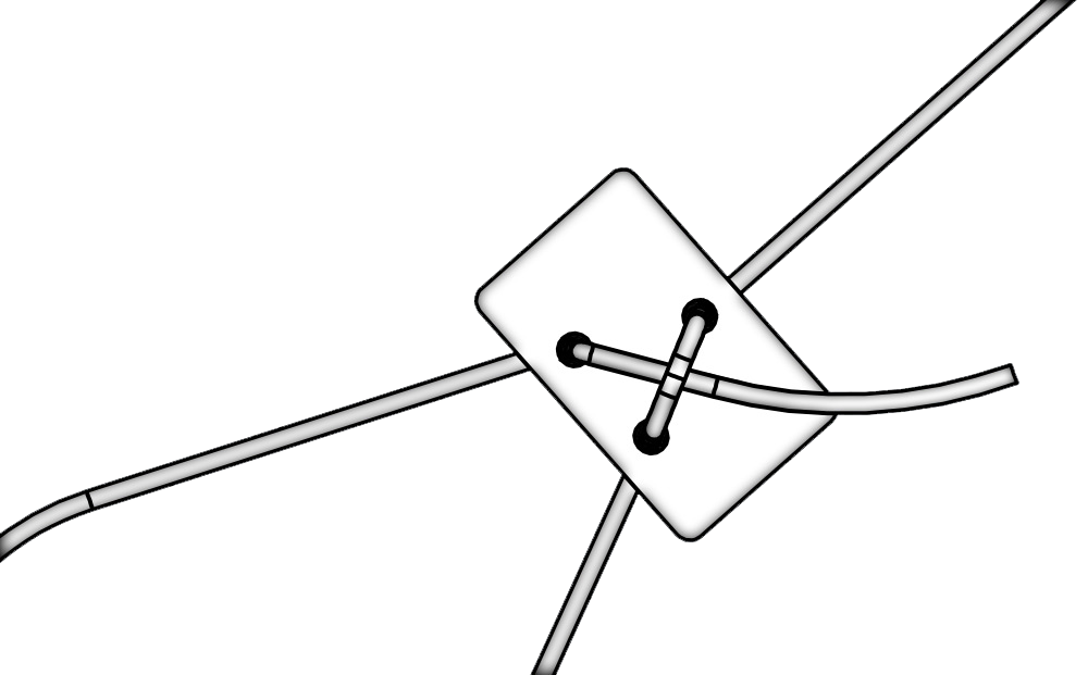 FDG-Home-CableBracing-02